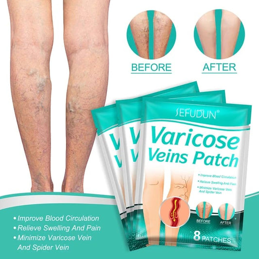 PARCHES PARA ELIMINAR LAS VARICES